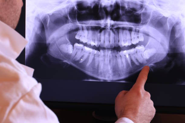 Best Emergency Broken Tooth Repair in Jamestown, TN